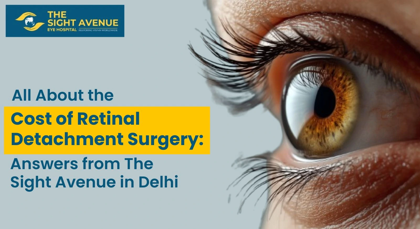 All About the Cost of Retinal Detachment Surgery: Answers from The Sight Avenue in Delhi